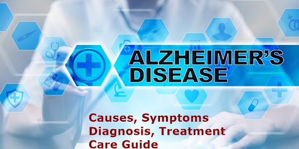 Alzheimer’s Disease Symptoms, Causes, Diagnosis & Treatments Guide
