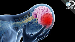 Bahan alami mengurangi kelumpuhan penderita stroke