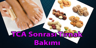 tca sonrası tırnak bakımı evde tırnak mantarı geçirme