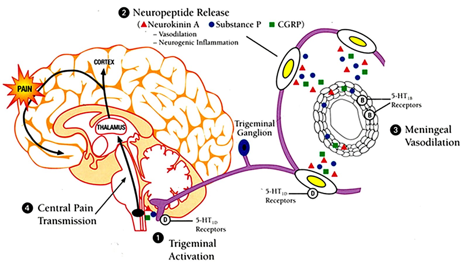 Triptan Triptans Side Effects Effect Choices
