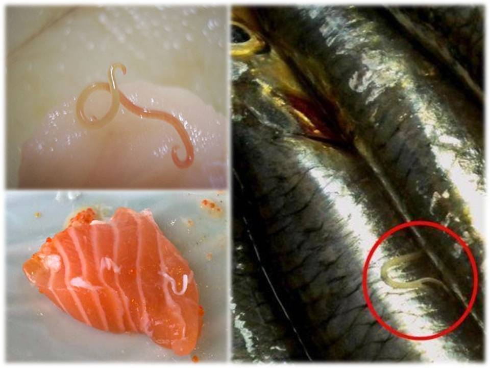 ANISAKIS, EL PARÁSITO DEL PESCADO CRUDO
