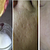 Natural Home Treatment That Can Defeat Botox for Tightening and Clears Pore Skin