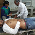 गोटेगांव- पत्रकार सड़क दुर्घटना में घायल प्राथमिक उपचार के बाद जबलपुर रेफर