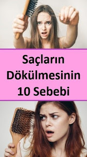 Saçların Dökülmesinin 10 Sebebi Saçların Dökülmesinin 10 Sebebi