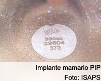 Sistema de salud reconocerá retiro de prótesis PIP si el médico lo recomienda