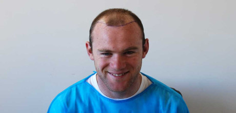 Chi ca ty dong cuu chua, toc cua Rooney van lo tho nhu ong gia - Anh 4