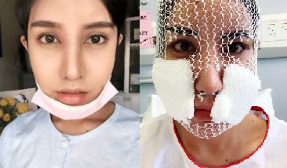Tuhan Nak Tunjuk!!! WAJAH TERBARU SAFIEY ILIAS SELEPAS MEMBUAT PEMBEDAHAN PLASTIK TERBARU PASTI BUAT KORANG TERKEJUT BERUK...
