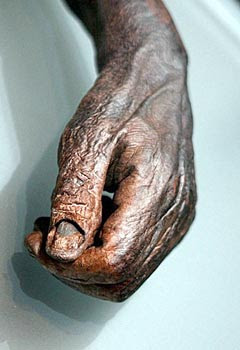Is Gold Naturally Found In The Human Body Is Gold Naturally Found In The Human Body