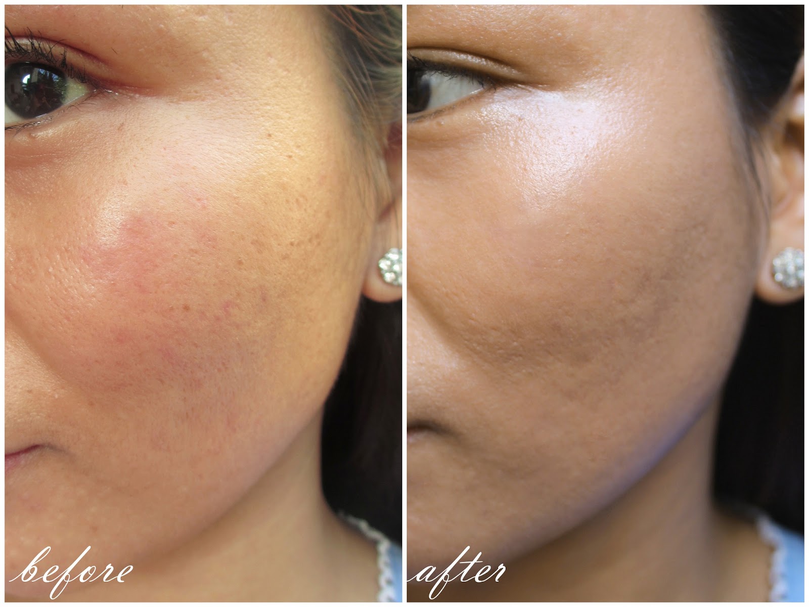 clear and smooth face cream