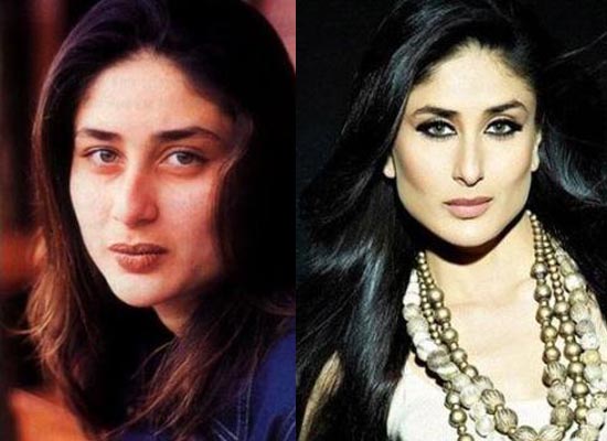 Kareena Kapoor before and after plastic surgery |Alia Bhatt