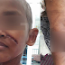 Budak 3 tahun dipukul & dicucuh dengan puntung rokok oleh bapa tiri
