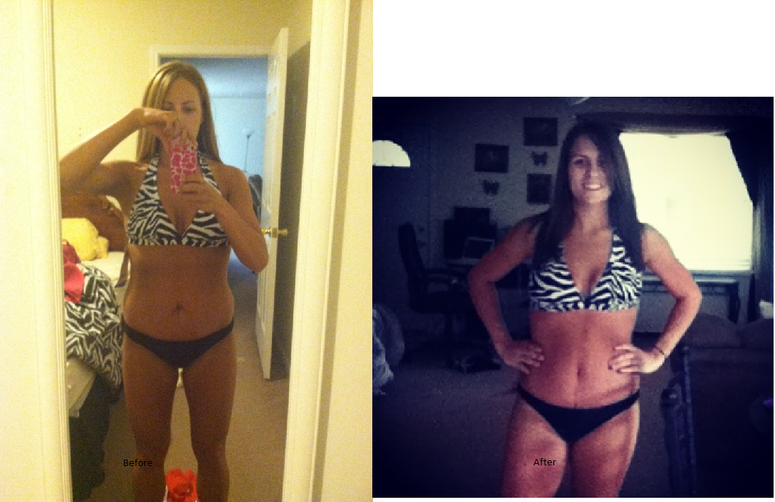 My Tummy Tuck Journey August 2013