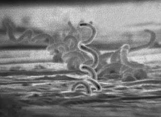 bakteri penyebab penyakit sifilis