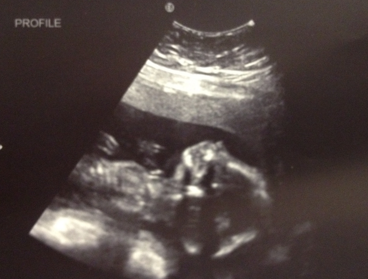 Finding Joy in Our Journey: Ultrasound...it's a BOY!!