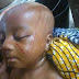 This Is Child Abuse - Imagine The Kind Of Tribal Mark Given To This Child