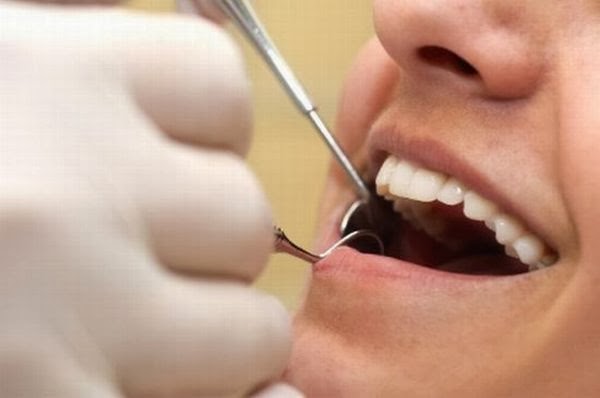 Sakit Gigi merupakan salah satu penyakit yang menciptakan orang merasa yang benar Obat Sakit Gigi Tradisional Alami