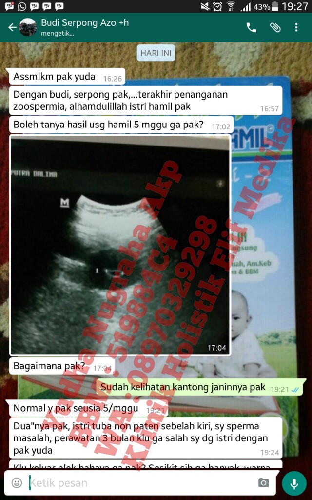 Tuba non paten, 3 bulan pengobatan alhamdulillah positif hamil Tuba non paten, 3 bulan pengobatan alhamdulillah positif hamil