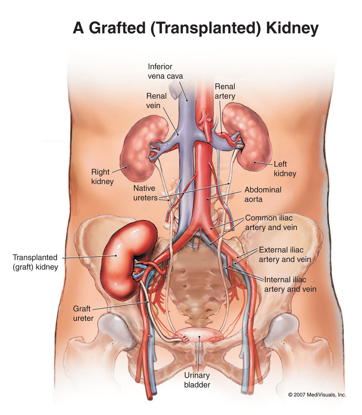 free-for-health-kidney-pain-causes