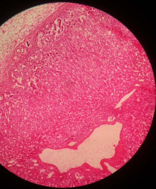 histology slide of adrenal cortex