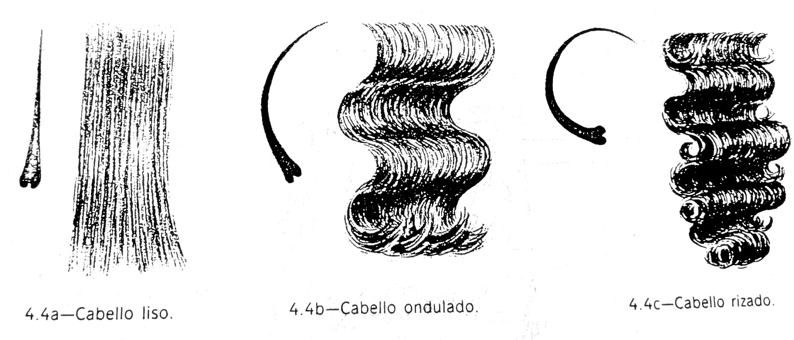 Cómo elegir la Prótesis capilar