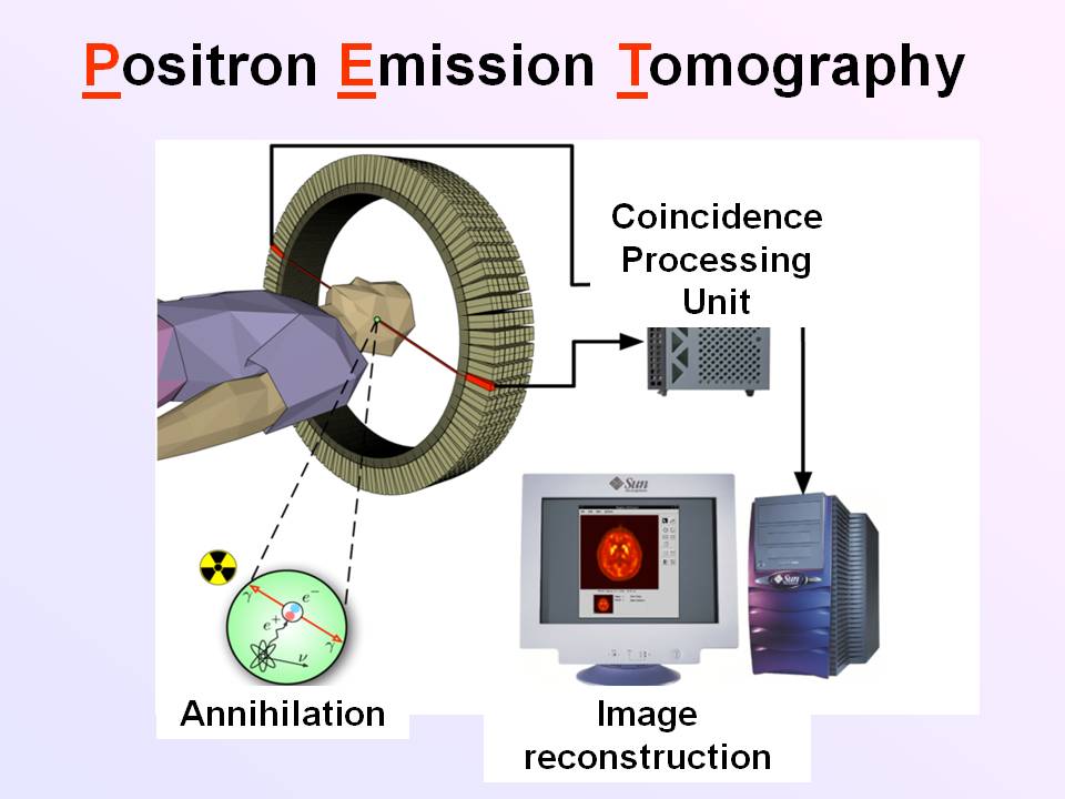 ektalks Science in Medicine Positron Emission Tomography (PET) with