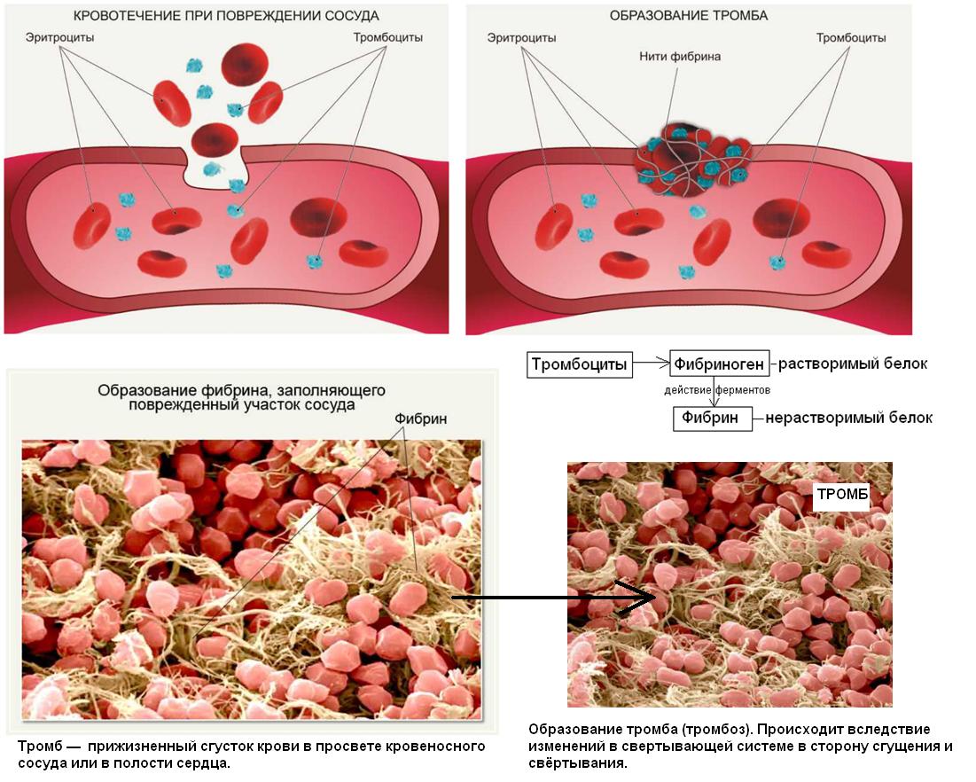 при повреждении сосудов тромбоциты. адгезия тромбоцитов к сосудистой стенке. при повреждении сосудов тромбоциты. механизм адгезии тромбоцитов. осаждение тромбоцитов на поврежденной поверхности.