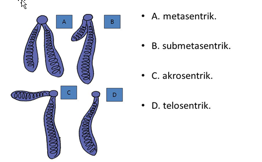 Sebutkan 4 jenis kromosom berdasarkan letak sentromernya