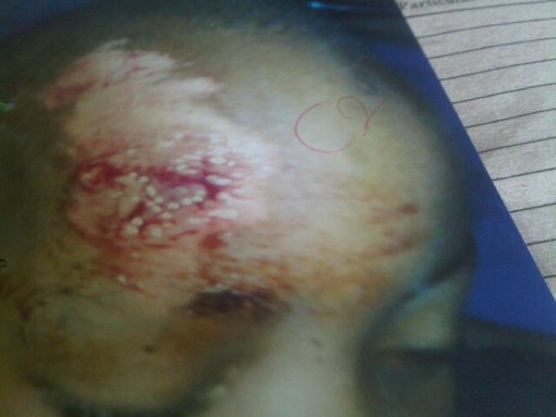 robbers attack baby lagos