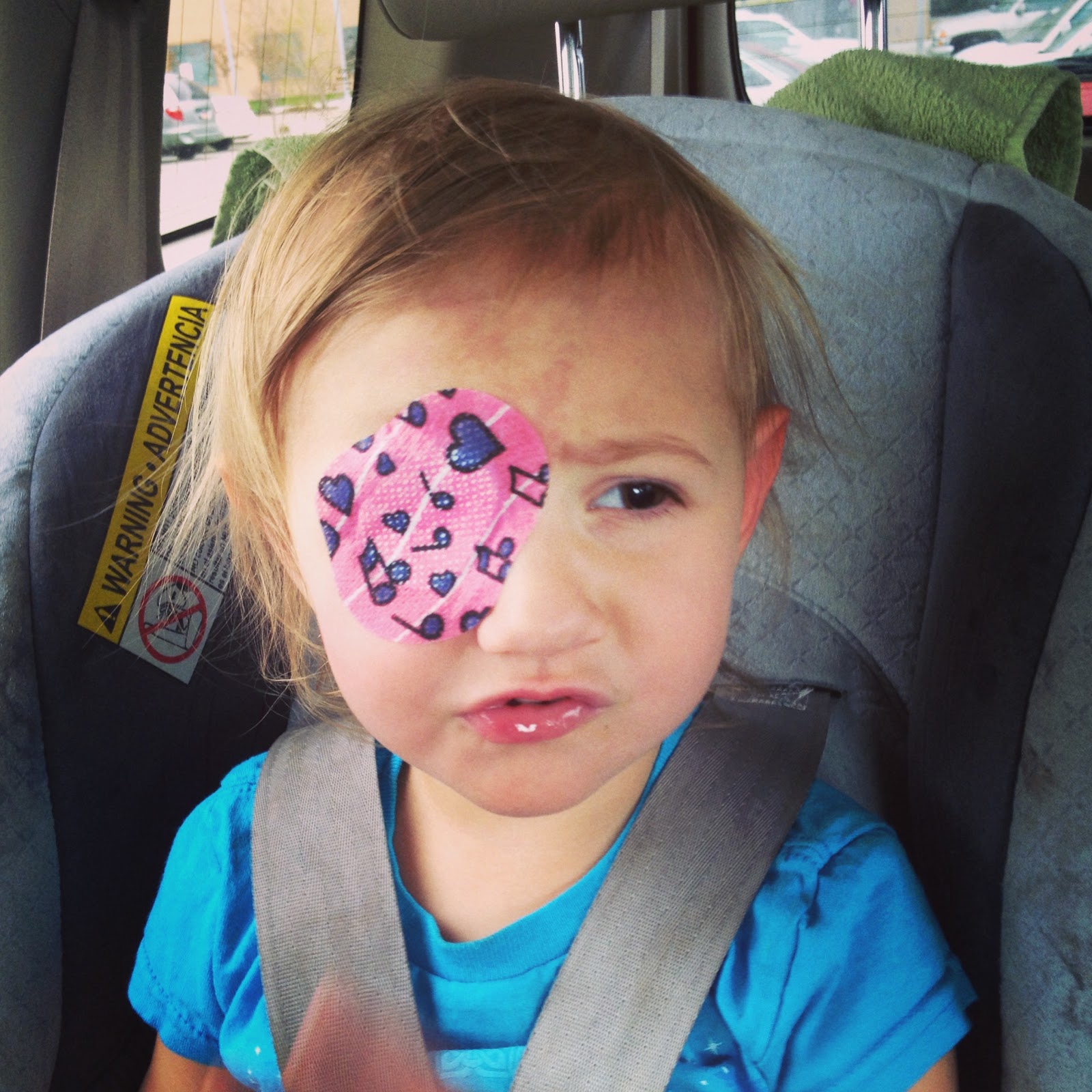 Sunshine and dimples exotropia