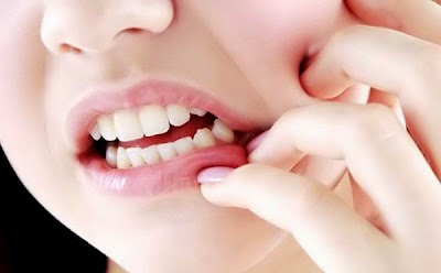  Bagi Anda yang pernah mencicipi sakit gigi niscaya pernah mencicipi bagaimana sakitnya yang Penyebab Munculnya Sakit Gigi
