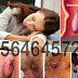 Obat Pereda Nyeri dan Bengkak Wasir (Hemoroid) thumbnail