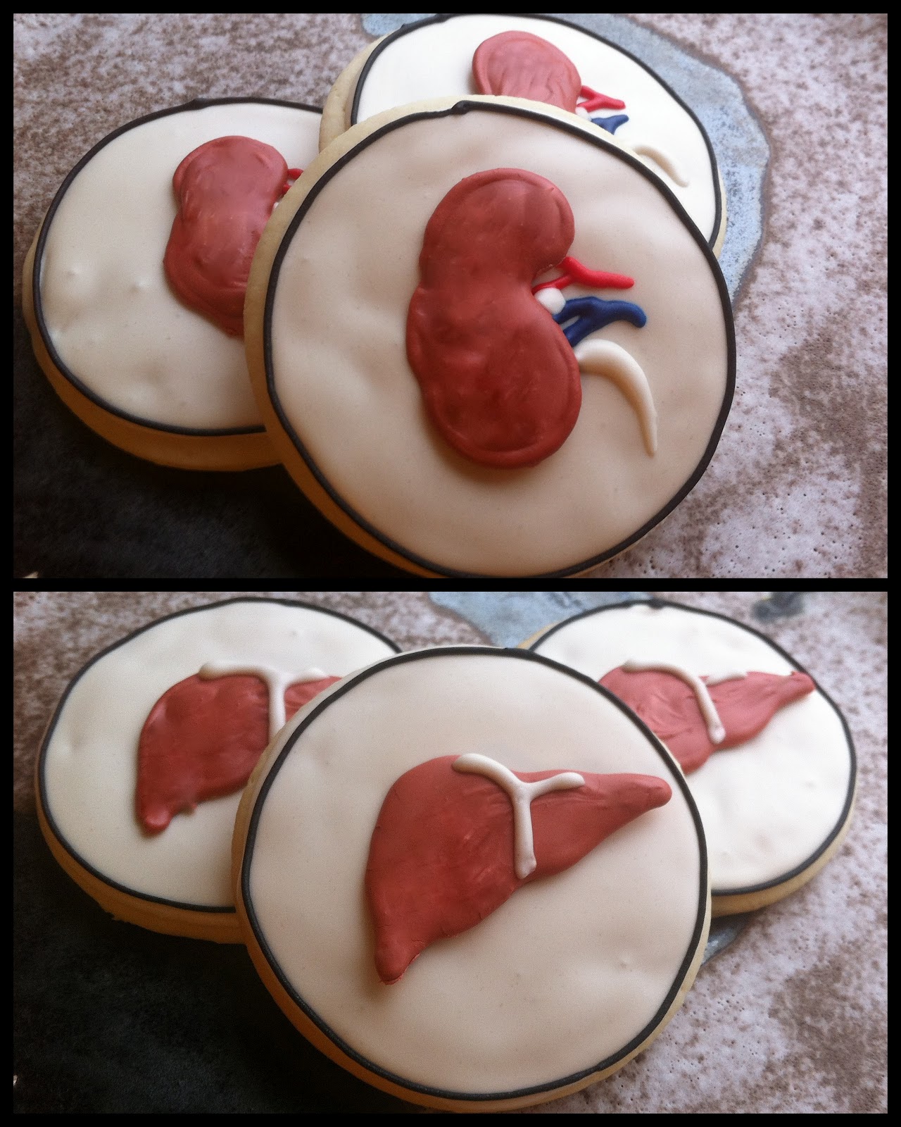 THE PAINTED COOKIE Kidney & Liver cookies for The Transplant Institute of Memphis