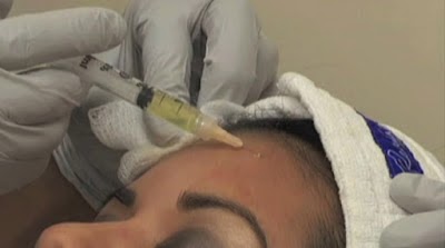 Tibbi Hacamat Ile Uyguladigimiz Tedaviler Geleneksel Ve Tamamlayici Alternatif Tip Getat Merkezi Dr Turansah Tumer