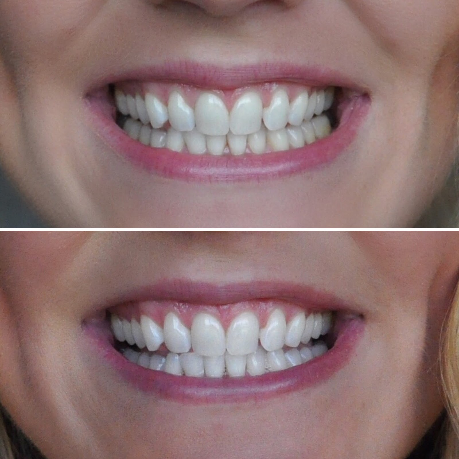 How I Whitened My Teeth Without Sensitivity (+ Giveaway!) Amanda's OK