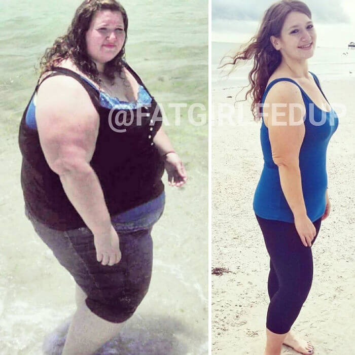 Incredible Before And After Pictures Of A Woman Who Used To Weigh 485lbs