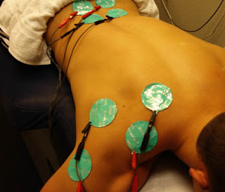 Electric Stimulation Therapy: 10 Ways to Deal with Back Pain