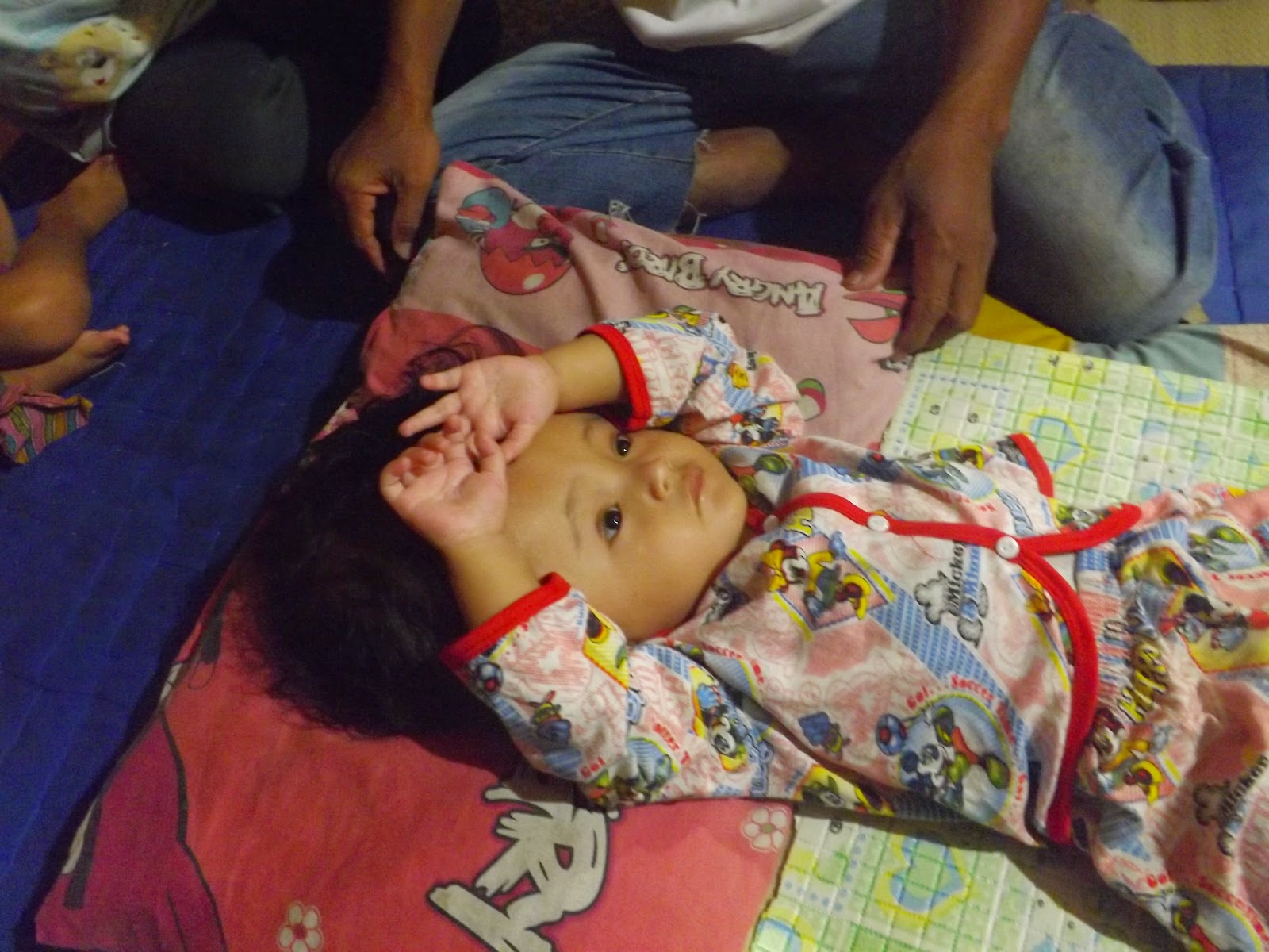 Bayi Penderita Hidrosefalus Tidak Mendapat Perhatian Pemerintah Setempat