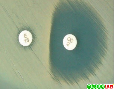 Large, rough, greenish-appearing, hemolytic colonies of Bacillus cereus on blood agar plate. Large, rough, greenish-appearing, hemolytic colonies of Bacillus cereus on blood agar plate.
