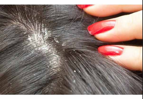 itching scalp causes