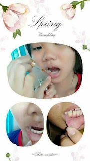 serum Kiều beauty queen serum Kiều beauty queen