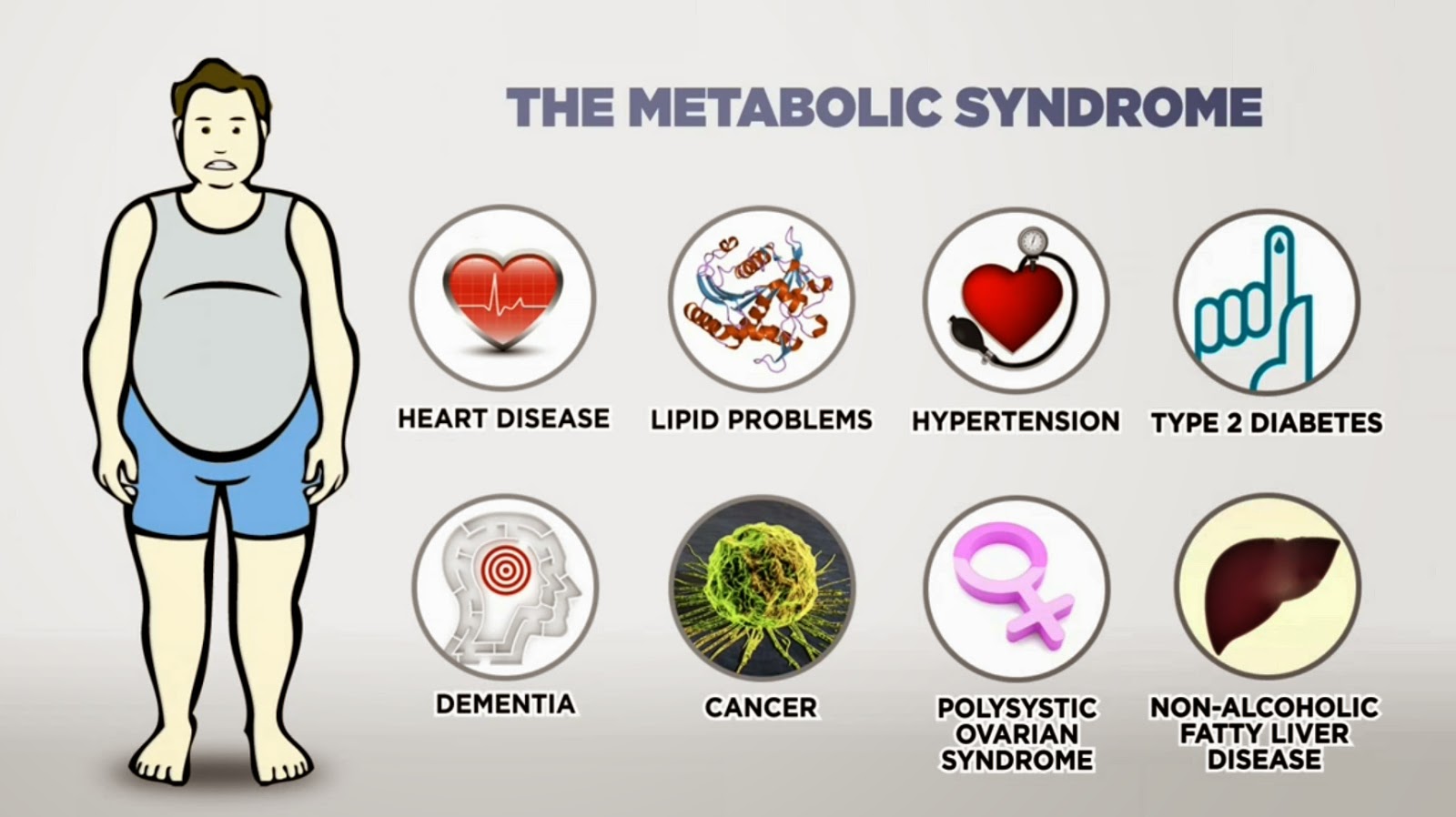 Metabolik Sendrom Nedir? Tedavisi NetteBilgi