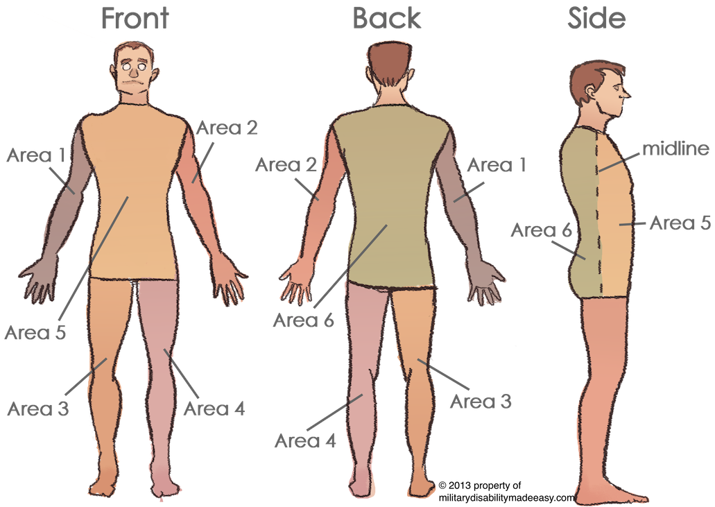 The Blog At Military Disability Made Easy Proposed Changes To The Ratings Of The Skin Are Now Open To Comments