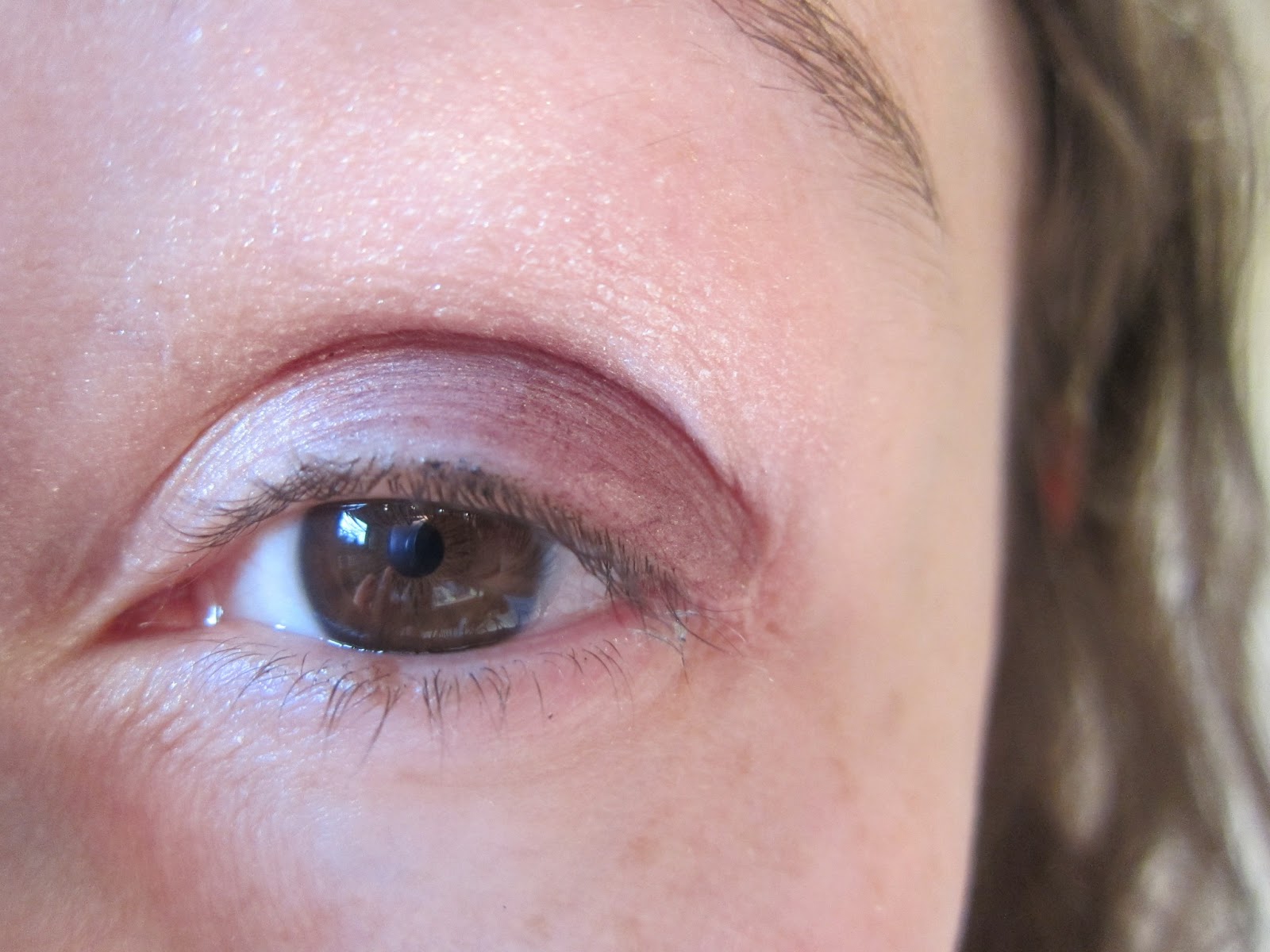 Petit Bouton Blanc Au Ras Des Cils Inférieur