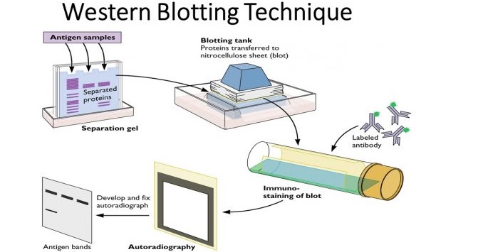 western blot sandwich order western blot sandwich order