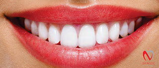 Bọc răng sứ quận 10 Dr Ngọc Nha khoa uy tín q10