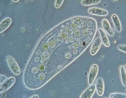 Paramaecium contoh species ciliophora/ciliata Filum Protozoa (Protista Mirip Hewan)
