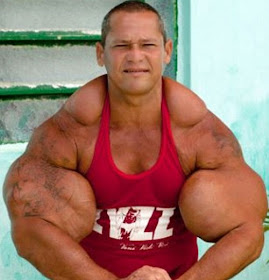 جنون الشهرة: رجل يخاطر بحياته من تضخيم عضلاته!