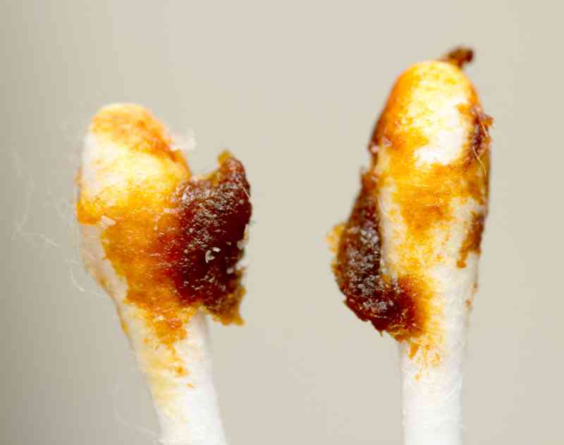 Our Ears Can Indicate Our Health, and These 8 Factors Shouldn’t Be