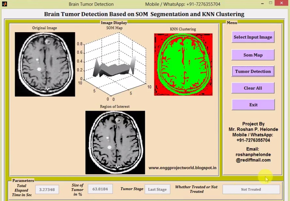 Brain Tumor Detection and Classification Using Clustering and