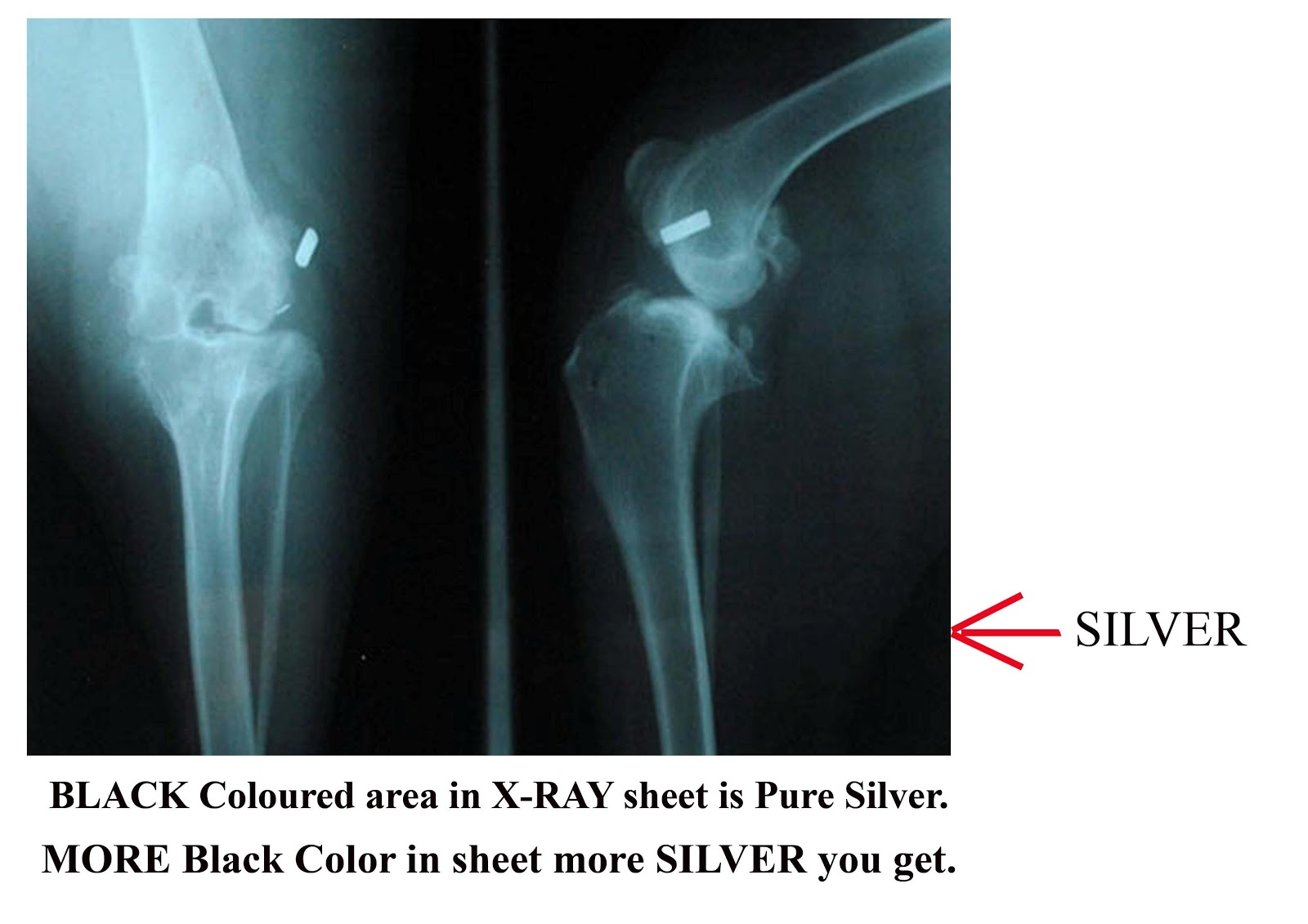 Silver 4Runner How To Extract Silver From X Ray Film